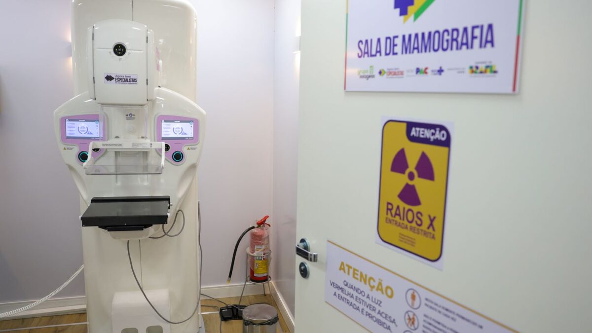 Equipamento de mamografia em sala de exame do SUS